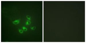 Immunofluorescence analysis of HepG2 cells using Anti-Tryptophan Hydroxylase Antibody. The right hand panel represents a negative control, where the antibody was pre-incubated with the immunising peptide.