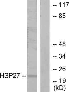 Western blot analysis of lysates from HeLa cells using Anti-HSP27 Antibody. The right hand lane represents a negative control, where the antibody is blocked by the immunising peptide.