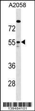 Anti-ARHGAP1 Rabbit Polyclonal Antibody (Biotin)