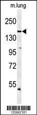 Anti-KDR Rabbit Polyclonal Antibody (AP (Alkaline Phosphatase))