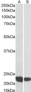 Anti-RAC2 Antibody (A83810) (0.1 µg/ml) staining of Human Thymus (A) and Tonsil (B) lysate (35 µg protein in RIPA buffer). Primary incubation was 1 hour. Detected by chemiluminescence