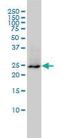 Anti-GRB2 Mouse Monoclonal Antibody [clone: 4C6-H6]