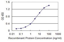 Anti-SSTR1 Mouse Monoclonal Antibody [clone: 1F7]