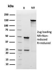 Anti-Human IgM Heavy Chain Mouse Recombinant Antibody [clone: rIM260]