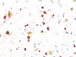 Immunohistochemistry analysis of paraffin-embedded mouse spinal cord using Anti-Casein Kinase 2 beta Antibody [ARC1069] (A309247) at a dilution of 1:100 (40X lens). Perform microwave antigen retrieval with 10 mM PBS buffer pH 7.2 before commencing with IHC staining protocol