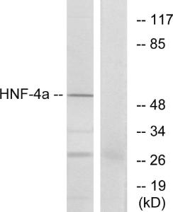 Western blot analysis of lysates from HT-29 cells using Anti-HNF4 alpha Antibody. The right hand lane represents a negative control, where the antibody is blocked by the immunising peptide.