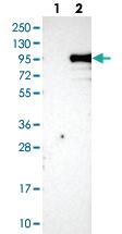 Anti-KIAA1586 Rabbit Polyclonal Antibody