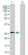 Anti-C1QTNF5 Mouse Polyclonal Antibody