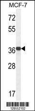 Anti-GPD1L Rabbit Polyclonal Antibody (FITC (Fluorescein Isothiocyanate))