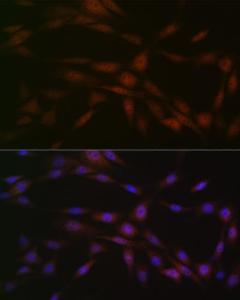 Immunofluorescence analysis of NIH-3T3 cells using Anti-Casein Kinase 2 beta Antibody [ARC1069] (A309247) at a dilution of 1:100 (40X lens). DAPI was used to stain the cell nuclei (blue)