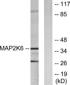 Western blot analysis of lysates from 293 cells using Anti-MAP2K6 Antibody. The right hand lane represents a negative control, where the antibody is blocked by the immunising peptide.