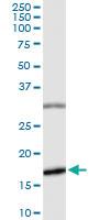 Anti-BIRC5 Rabbit Polyclonal Antibody