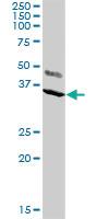 Anti-KCNIP2 Rabbit Polyclonal Antibody