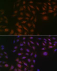 Immunofluorescence analysis of U-2 OS cells using Anti-Casein Kinase 2 beta Antibody [ARC1069] (A309247) at a dilution of 1:100 (40X lens). DAPI was used to stain the cell nuclei (blue)