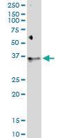 Anti-BSG Polyclonal Antibody Pair