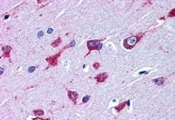 Anti-ALS2 Antibody (A83811) (38 µg/ml) staining of paraffin embedded Human Cortex Steamed antigen retrieval with citrate buffer pH 6, AP-staining