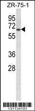 Anti-GPD2 Rabbit Polyclonal Antibody (AP (Alkaline Phosphatase))