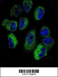 Anti-IL13 Rabbit Polyclonal Antibody (FITC (Fluorescein Isothiocyanate))