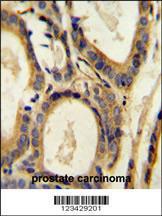 Anti-CCL4 Rabbit Polyclonal Antibody (PE (Phycoerythrin))