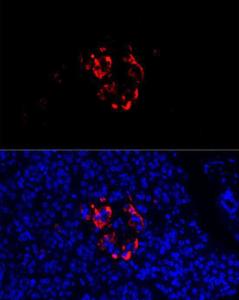 Immunofluorescence analysis of human pancreas cells using Anti-Chromogranin C/SGII Antibody (A9862) at a dilution of 1:100 (40x lens) DAPI was used to stain the cell nuclei (blue)