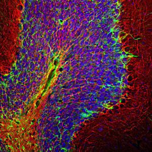 Immunohistological analysis of a rat cerebellum section stained with Anti-NF-H Antibody (1:5,000/red) and Anti-GFAP Antibody (A85419/1:5,000/green)