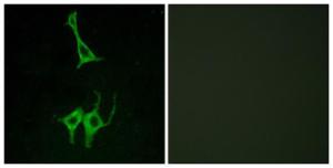 Immunofluorescence analysis of LOVO cells using Anti-NMUR1 Antibody. The right hand panel represents a negative control, where the antibody was pre-incubated with the immunising peptide