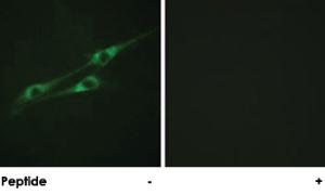 Anti-IL13RA1 Rabbit Polyclonal Antibody