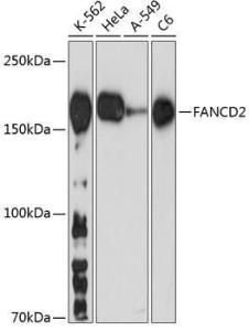 Anti-FANCD2 antibody