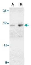 Anti-BCAP29 Rabbit Polyclonal Antibody