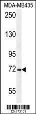 Anti-ARHGAP10 Rabbit Polyclonal Antibody (AP (Alkaline Phosphatase))