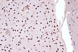 Immunohistochemistry analysis of paraffin-embedded rat brain using Anti-FUBP1 / FBP Antibody [ARC1403] (A309248) at a dilution of 1:100 (40x lens). Perform microwave antigen retrieval with 10 mM Tris/EDTA buffer pH 9.0 before commencing with IHC staining protocol.