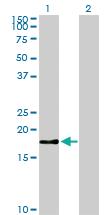 Anti-BIRC5 Mouse Monoclonal Antibody [clone: 5B10]