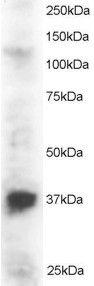 Anti-PINX1 Antibody (A83813) staining (2 µg/ml) of Jurkat lysate (RIPA buffer, 30 µg total protein per lane). Primary incubated for 1 hour. Detected by western blot using chemiluminescence