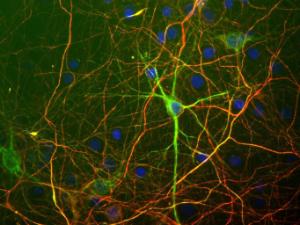 Mixed neuron/glial cultures stained with Anti-NF-L Antibody (A85453/green) and Anti-NF-H Antibody (red)