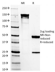 SDS-PAGE analysis of Anti-TMEM16A Antibody [DG1/1485] under non-reduced and reduced conditions; showing intact IgG and intact heavy and light chains, respectively. SDS-PAGE analysis confirms the integrity and purity of the antibody.