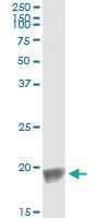 Anti-BIRC5 Mouse Monoclonal Antibody [clone: 5B10]