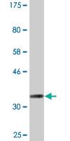 Anti-CKMT1B Mouse Monoclonal Antibody [clone: 2C9]