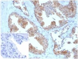 Immunohistochemical analysis of formalin-fixed, paraffin-embedded human prostate tissue using Anti-MIF Antibody [MIF/3490]. Inset: PBS instead of the primary antibody. Secondary antibody negative control