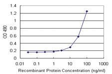 Anti-TIMP1 Mouse Monoclonal Antibody (Biotin)