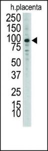 Anti-DDR1 Rabbit Polyclonal Antibody (APC (Allophycocyanin))