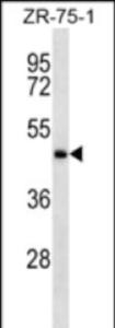 Anti-IGHE Rabbit Polyclonal Antibody (HRP (Horseradish Peroxidase))