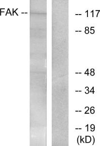 Western blot analysis of lysates from Jurkat cells, treated with CD3 antibody using Anti-FAK Antibody. The right hand lane represents a negative control, where the antibody is blocked by the immunising peptide