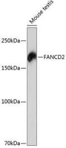 Anti-FANCD2 antibody