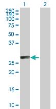 Anti-C1QTNF6 Mouse Polyclonal Antibody