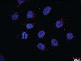 Anti-PDGFRB + FLT1 Antibody Pair