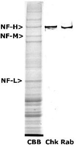 Lane labelled CBB shows Coomassie Brilliant Blue stained crude extract of rat spinal cord, with the prominent major neurofilament subunit indicated In rodents, NF-H runs at 200kDa, NF-M at 145kDa and NF-L at 68kDa