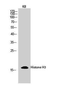 Western blot analysis of KB cells using Anti-Histone H3 Antibody