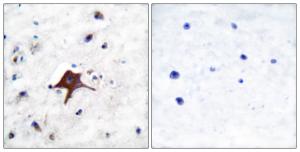 Immunohistochemical analysis of paraffin-embedded human brain tissue using Anti-GLUT3 Antibody The right hand panel represents a negative control, where the antibody was pre-incubated with the immunising peptide