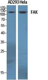 Western blot analysis of various cells using Anti-FAK Antibody