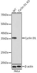 Western blot analysis of extracts from wild type (WT) and Cyclin D1 knockout (KO) HeLa cells, using Anti-Cyclin D1 Antibody [ARC0300] (A306339) at 1:1000 dilution. The secondary Antibody was Goat Anti-Rabbit IgG H&L Antibody (HRP) at 1:10000 dilution